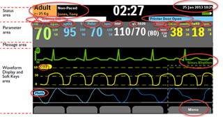 Screenshot of Trados Studio user guide with circled text elements. Status area shows 'Adult' and 'Non-Paced' with a warning 'Printer Door Open'. Parameter area displays vital signs. Message area has 'Sinus Rhythm' alert. Date and time are visible.